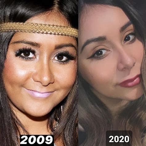 Snooki Face Surgery