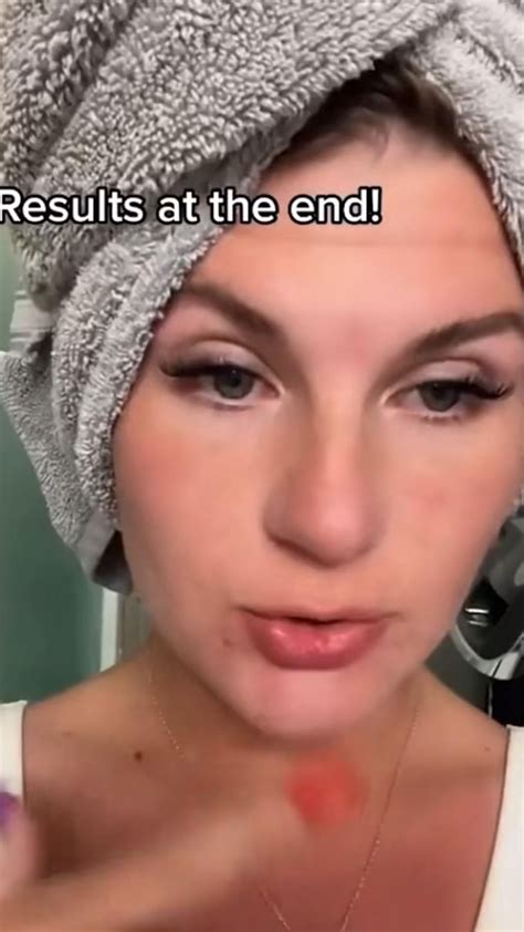 How to turn sun burn into sun tan – Artofit