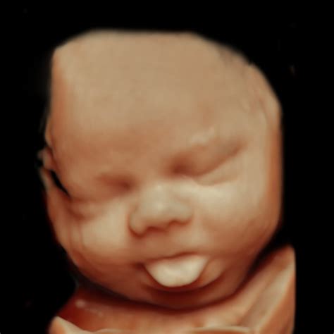 Capturing Moments: The Magic of 3d Ultrasound - Baby Studio 4D