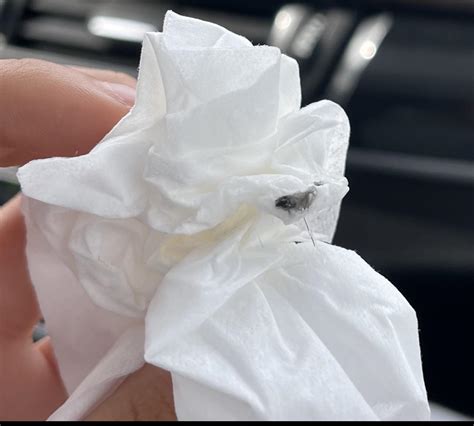 Black Mucus & Respiratory Concern : r/medical