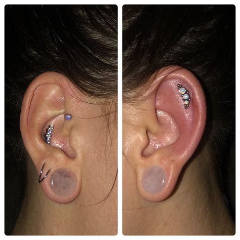 My normal ear vs my ear with infected helix piercing. For those of you ...