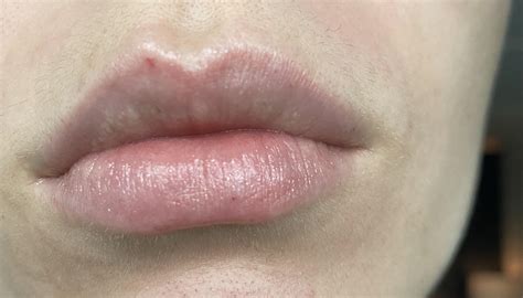 Does anyone have hair that is just a giant sphere : r/deepwoken