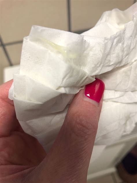 White Discharge After Ovulation