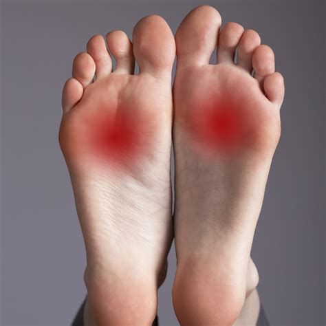 Painful Red Spot On Bottom Of Foot Online | emergencydentistry.com