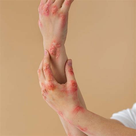 Medical Dermatology - EDCC