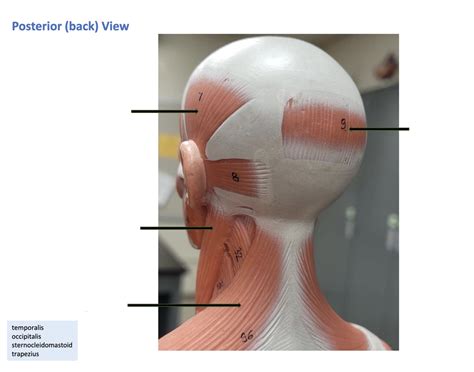 posterior view of head and neck muscle Quiz