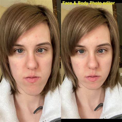 My breast reduction & lift journey 4mpo : r/PlasticSurgery