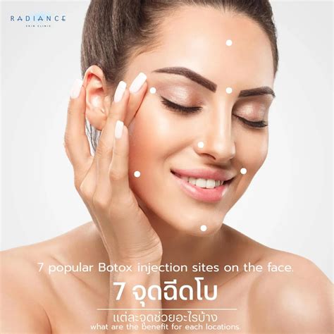 Revealing the seven most popular injection sites for Botox on the face. - Radiance Skin Clinic ...