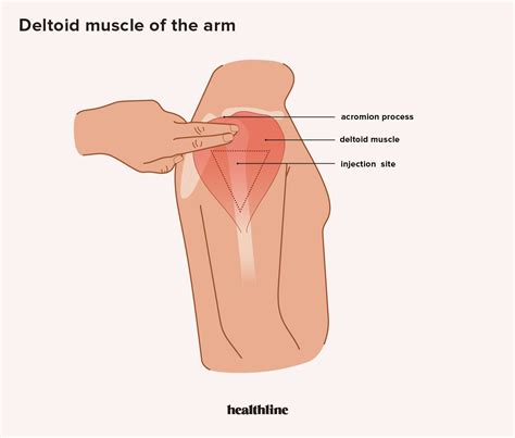 Intramuscular Injection | Patient education, Im injection, Injections