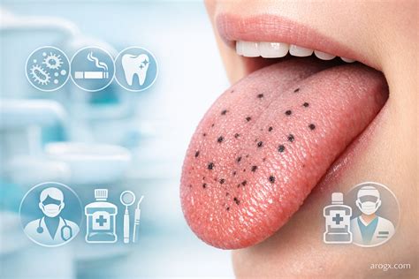 Black Spots on Tongue: Causes, Symptoms & Treatment - Arogx