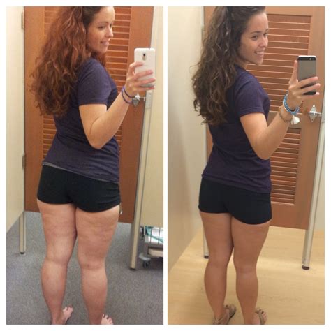 Cellulite Weight Loss