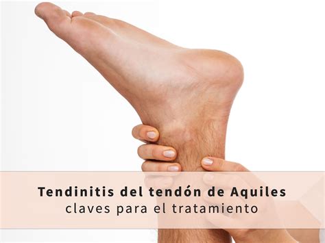 ¿dolor en los tobillos? podría ser tendinitis de aquiles | tendinitis ...