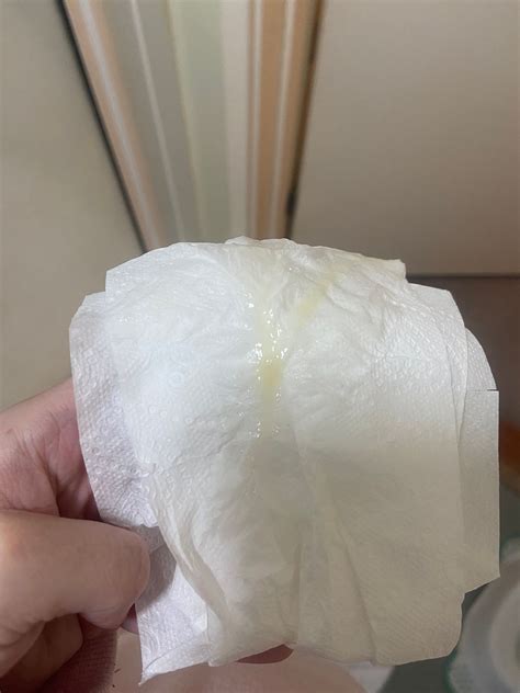 TMI* is this Bv discharge? | BabyCentre