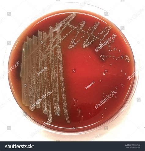 Types Of Hemolysis On Blood Agar at Melvin Johnson blog