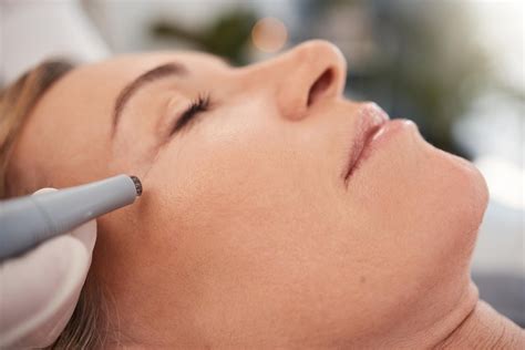 Ablative CO2 Fractional Laser Resurfacing with Secret PRO - Chandni Aesthetics