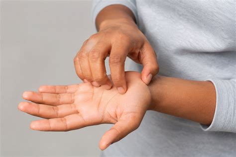Meaning of Itching Palms: Myths, Beliefs and Possible Medical Causes ...