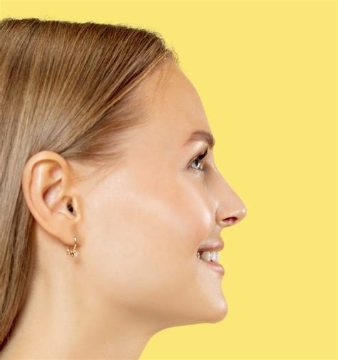 What is Otoplasty? (Ear Pinning Surgery) - Magic Touch Turkey