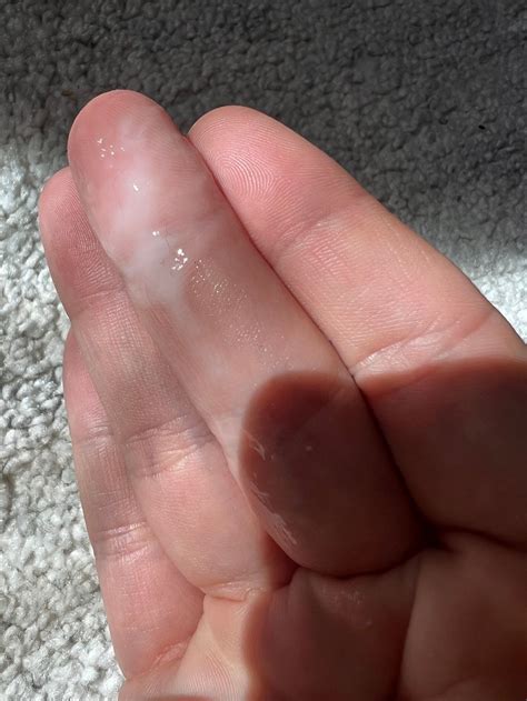 White Ovulation Discharge