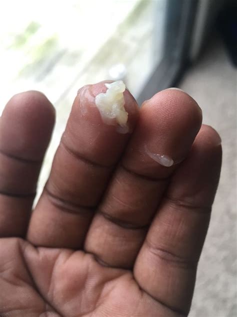 mucus plug vs discharge - prenatal vitamins