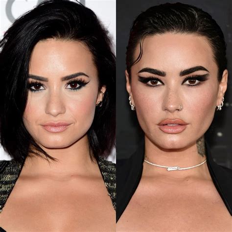 Demi Lovato Face Surgery