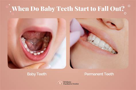 When Do Baby Teeth Fall Out?