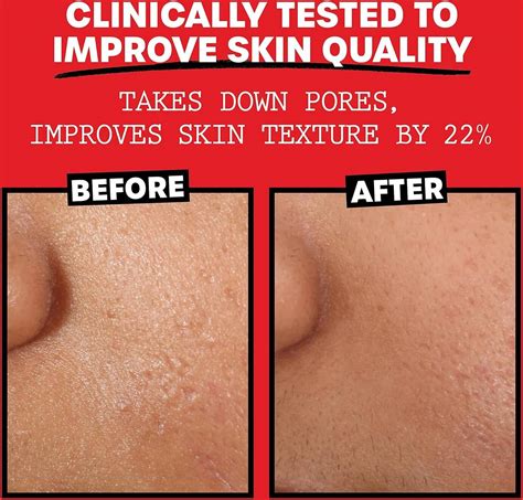 Thayers Alcohol-Free Witch Hazel With Organic Aloe Vera Formula Toner ...