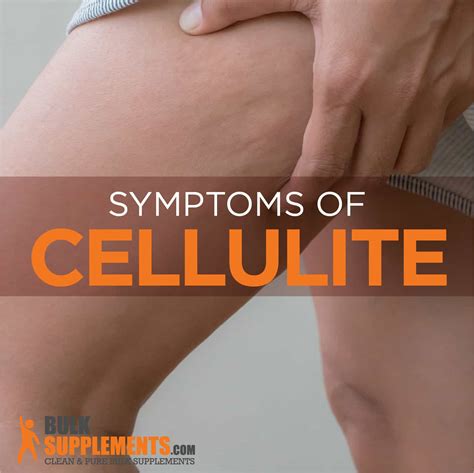 Cellulite Characteristics, Causes and Treatment