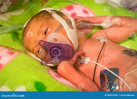 Preemie Baby Girl Sucking on Her Pacifier Stock Photo - Image of baby ...