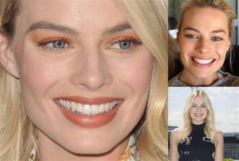 Margot Robbie Teeth Before and After