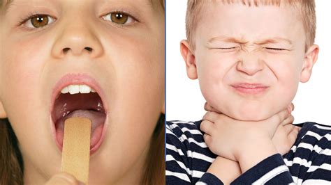 Symptoms of Strep Throat in Kids: How to Identify Them Early