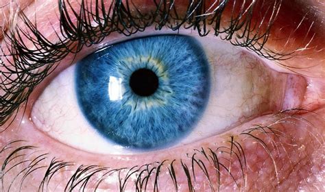 Why Do My Eyes Hurt? Top 12 Causes You Should Be Aware Of