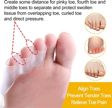 Callus in between pinky toe. Callus Between Pinky Toe: Causes, Symptoms, and Treatments for Foot ...