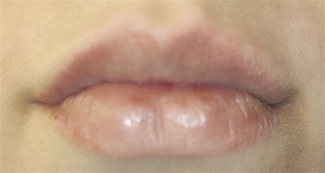 Why Do Lip Balms Dry Out My Lips? Uncover the Truth! – Truly Fair Cosmetics