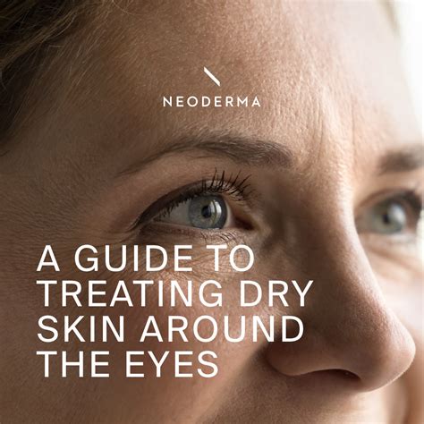 A Guide To Treating Dry Skin Around The Eye | NEODERMA