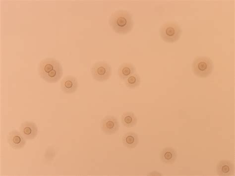 Mycoplasma Pneumoniae Agar
