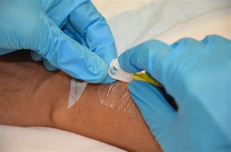 Flush Method Medical Term at Janice Kiefer blog