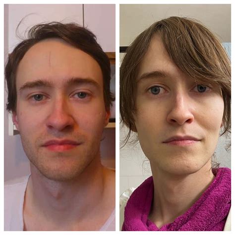Pre-HRT 6 years ago, and 14 months on hormones. This was taken a couple ...