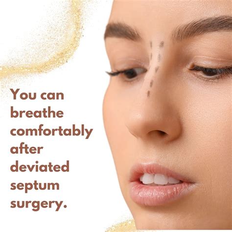 Deviated Septum Surgery: Procedure, Recovery, Risks in Turkey