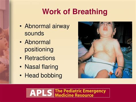 PPT - Approach to the Critically Ill Child PowerPoint Presentation ...
