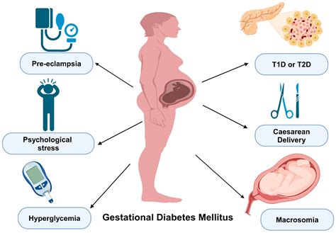 Does Gestational Diabetes Go Away