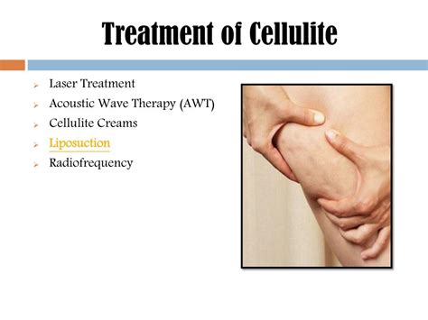 PPT - Cellulite: Causes, risk factors and treatment PowerPoint Presentation - ID:7486709