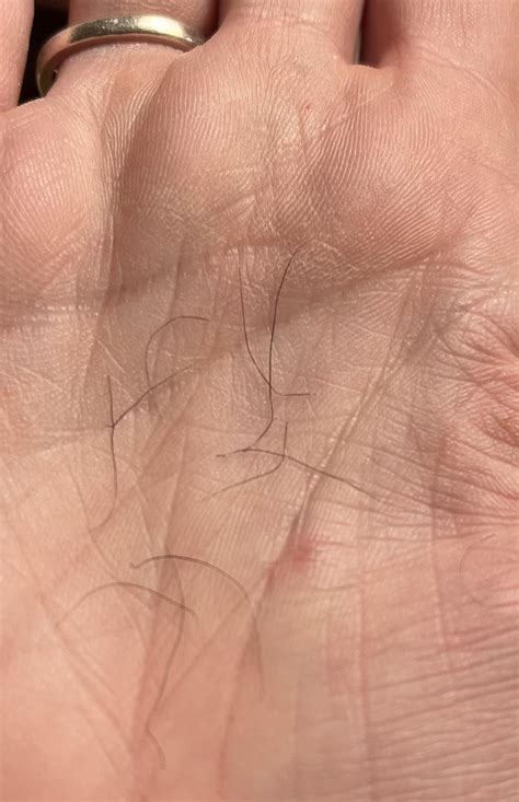 Hair (happy trail) : r/PCOSloseit