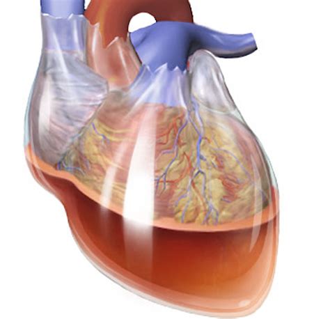 Cardiac tamponade causes symptoms and treatment – Artofit