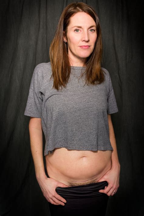 10 Incredible C-Section Stories—and the Scars That Go With Them | SELF