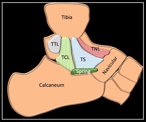 Deltoid Ligament Mri