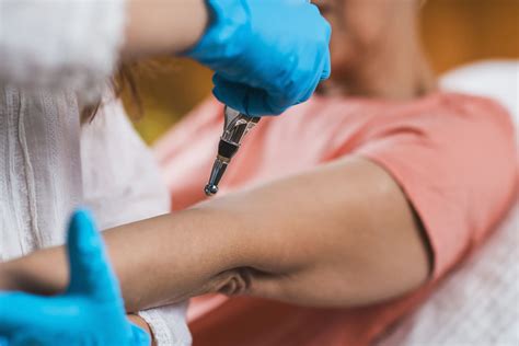 Understanding Acupuncture Golfer's Elbow: A Comprehensive Guide ...