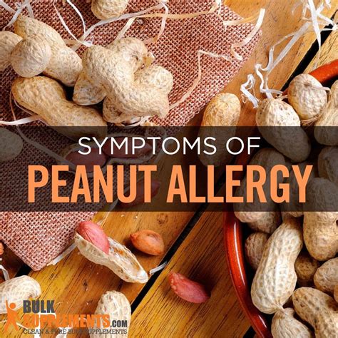 Peanut Allergy? Learn about Symptoms,Treatment & Supplements.