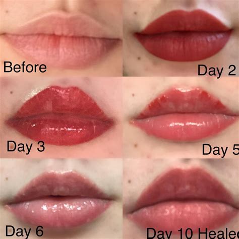 Permanent Lip Color Healing Process at Kenneth Britt blog