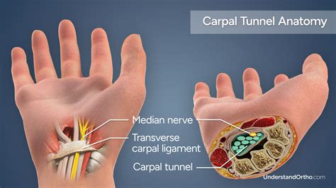 Carpal Tunnel Bones