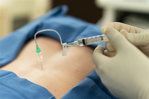 Epidural, la posibilidad de un parto sin dolor | Winny